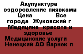 Акупунктура, оздоровление пиявками › Цена ­ 3 000 - Все города, Жуковский г. Медицина, красота и здоровье » Медицинские услуги   . Ненецкий АО,Варнек п.